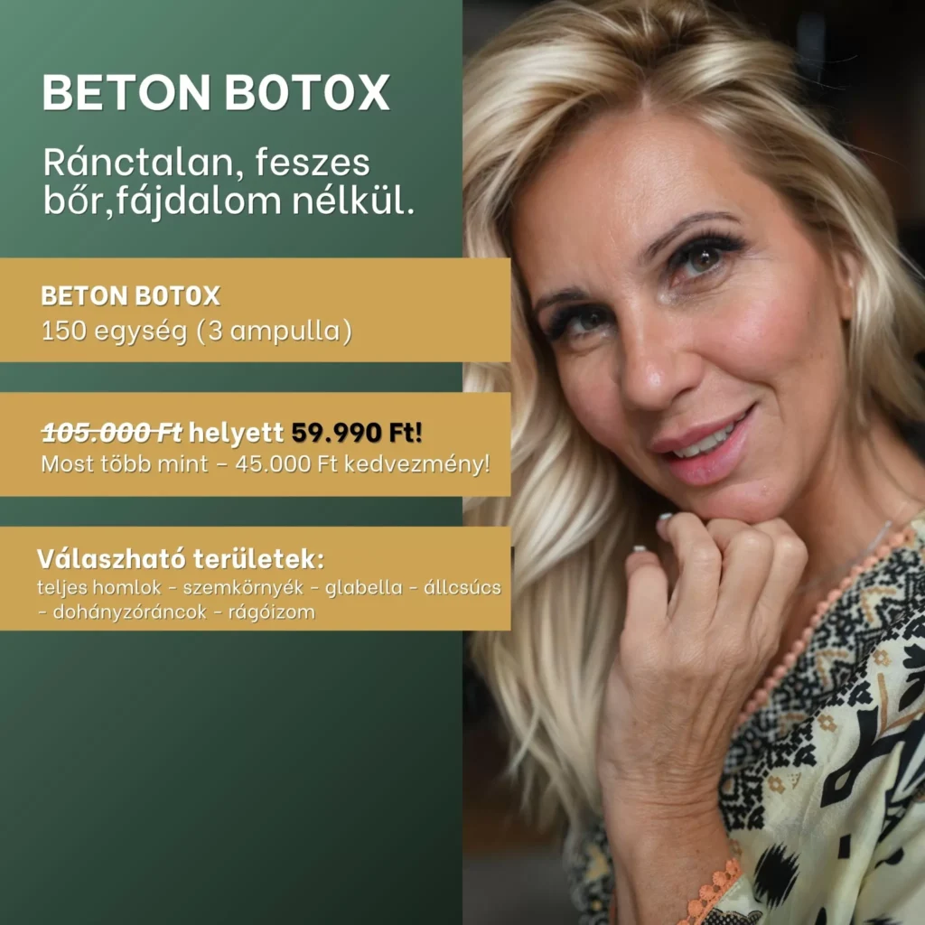 Beton b0t0x