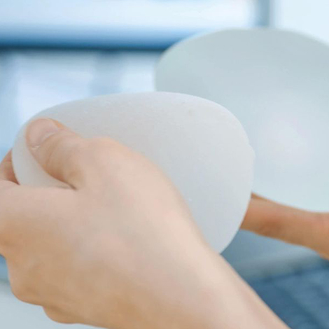 A poliuretán felületű implantátumokról tényszerűen