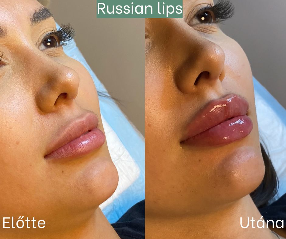 russian lips russian lips