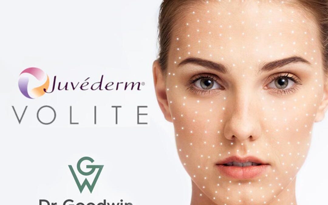 Juvederm Volite – A Bőr Varázslatos Megújítása!