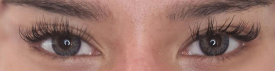 Fox Eye kezelés